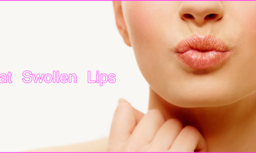 Top 5 Home Remedies To Treat Swollen Lips