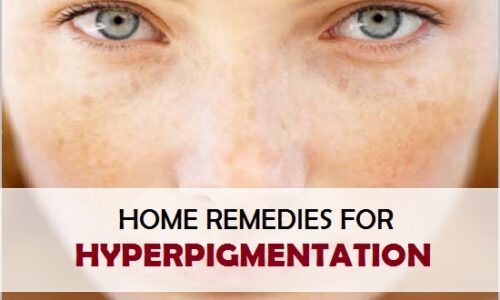 7 Natural Home Remedies to Reduce Skin Pigmentation