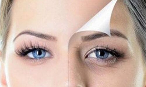 How to Remove Your Dark Circles