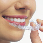 Can You Get Invisalign with Wisdom Teeth