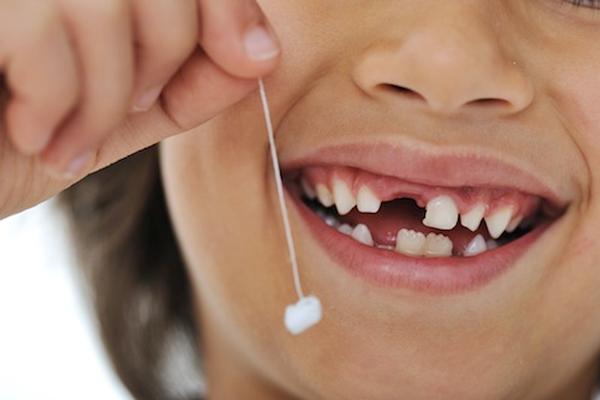 Taking Charge: What to Do When Your Front Tooth is Loose
